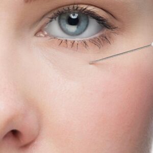 LG House of Beauty Tear Trough Filler