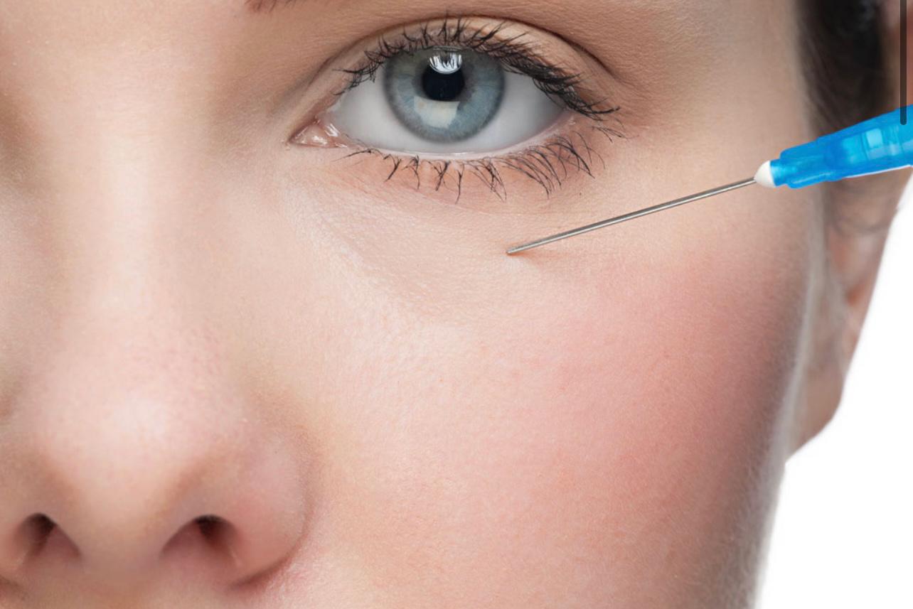 LG House of Beauty Tear Trough Filler