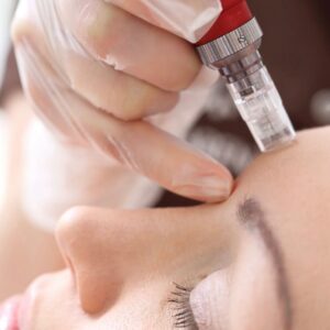 Microneedling & BB Glow Course