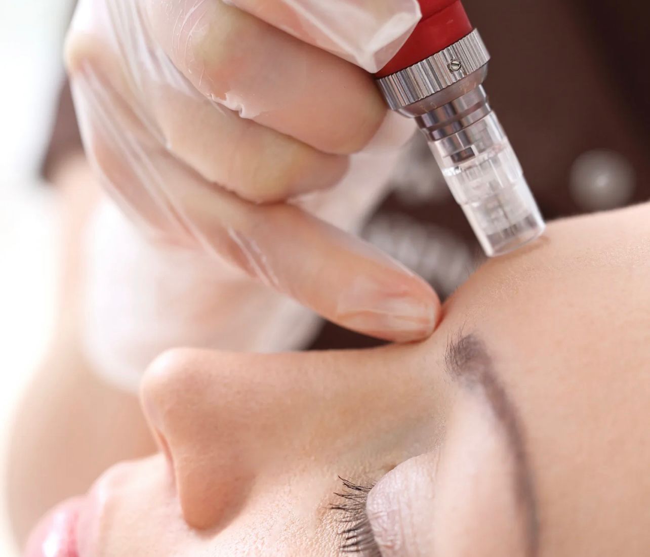 Microneedling & BB Glow Course